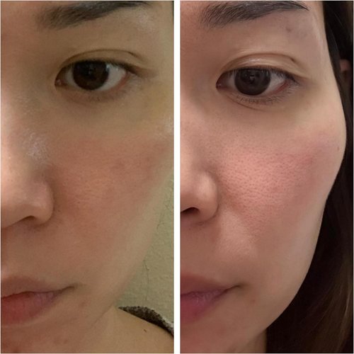 Korean Skin Care Set - Simplified Kbeauty Skincare Kits - Asian Skincare Facial Kit & Sets with Water Based Cleanser, Essence Toner, Under Eye Patches, Face Mask Sheets, Self Care Gifts For Women