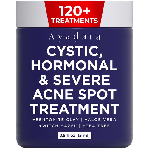 Ayadara Cystic Acne Spot Treatment, Overnight Hormonal Cystic Acne Treatment for Face, Women, Men and Teens, Cystic Hormonal Acne Treatment for Body, Pimple Cream, Sulfur Acne Spot Treatment, 120 Uses