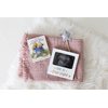 Tiny Ideas Love at First Sight Sonogram Picture Frame, Pregnancy Keepsake Photo Frame, Ultrasound Keepsake, Gender-Neutral Baby Nursery Décor, 4" x 6" Photo Insert, Gold Silver And White