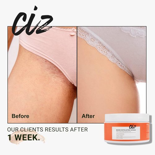 Bikini Area Exfoliator, Exfoliating Scrub for Bikini Area, Ingrown Hair Treatment for Bikini Area, Razor Bump Treatment for Bikini Area, Sugar Scrub for Bikini Area, Shaving Exfoliator Scrub for Women