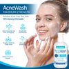 Vigority Benzoyl Peroxide Acne Treatment Wash: 10% Benzoyl Peroxide Face Body Wash - Maximum Strength Ance Non-Foaming Facial Wash - Fast Acting Acne Control Cleanser