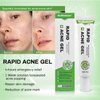 Dr.Medsam Rapid Ance Gel, Salicylic Acid Acne Treatment Acne Control Gel Inhibit Color Sink, Eliminate Acne Anti-inflammatory Sterilization Improve the Oil Pox Skin 20g/0.7Oz