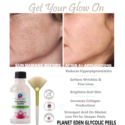 Planet Eden 50% Glycolic Acid Chemical Skin Peel Kit with Antioxidant Recovery Cream and Fan Brush - Diminish the look of Dark Spots, SUN DAMAGE, Wrinkles/fine lines, Age/Dark Spots