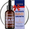 MOERIE Ultimate Hair Growth Serum for Natural Hair Regrowth & Thickening - Anti Thinning & Hair Loss Treatment for Women - Rapid Hair Growth Products - Scalp Oil Alternative - 1.69 fl oz / 50 ml