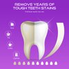 Teeth Whitening Strips-Pack of 28 Strip-14 Treatments Kit-Safe for Enamel-Whitening Without Any Harm-Sensitivity Free Dry Strip Technology for Coffee and Other Stains