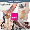 mediven Plus for Men & Women, 20-30 mmHg Thigh High Stockings, Open Toe Socks w/ Attachment