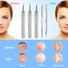 YGQQOY Blackhead Remover Tool, 5Pcs Acne Remover comedone Extractor, Professional Stainless Skin Zit Acne Blemish Whitehead Popping Removing Surgical Tweezers Extraction Tools for Nose Eye Face