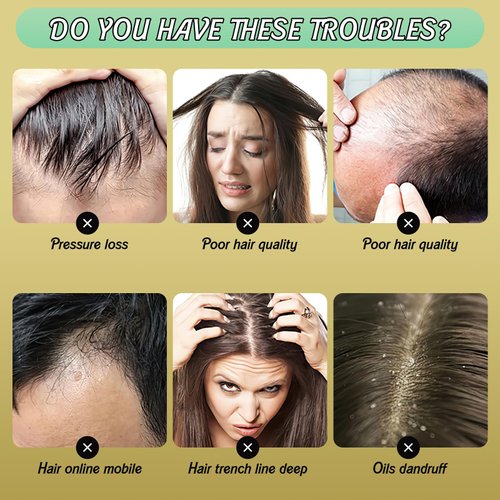 Ginger Plant Extract Hair Shampoo,Polygonum Multiflorum Hair Care, Strengthening,Thickening Shampoo for Women Men (3PCS)