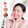 UOG Face Serum Complex – Hydrating & Firming Formula, Improves Skin Tone, Lifts & Firms Face, Neck, Jawline; Reduces Fine Lines, Wrinkles, Age Spots, Advanced Skin Care. Face Cream. 30ml/1.0oz