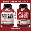 Apple Cider Vinegar Capsules with The Mother - 120 Vegan ACV Pills - Best Supplement for Healthy Weight Loss, Diet, Keto, Digestion, Detox, Immune - Powerful Cleanser & Appetite Suppressant Non-GMO