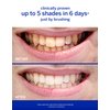 Supersmile Professional Teeth Whitening System - whitening toothpaste and accelerator - Whitens Up to 6 Shades