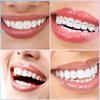 377 Pieces Tooth Gem Kit Tooth Jewelry Kit DIY Fashionable Tooth Artificial Crystal Reflective Tooth for Halloween Christmas Teeth Party Decorations (Stylish Style)