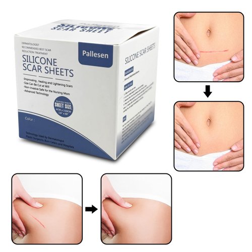 Pallesen Silicone Scar Sheets, Silicone Scar Tape, Brown 1.6”X 60” Scar Tape,Silicone Tape For Scars,Scar Sheets For Surgical Scars,For C-Section, Tummy Tuck, Acne Scar Treatment, Keloid Scar Remova