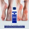 Blue Cross Callus Remover Gel for Feet or Heel, Extra Strength Professional Nail Care, File, Shaver, Scrubber & Pumice Stone Alternative for at Home Manicure/Pedicure Results, 6oz