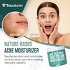 TreeActiv Salicylic Acid Face Moisturizer, 2 fl oz, Acne Treatment Face Cream for Oily Skin with and Tea Tree Oil, For Teens and Adults with Acne Prone Skin and Cystic Acne, 90 Day Supply