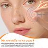 muhratii 2 Pcs Microdart Acne Patch for Face, Hyaluronate, Salicylic Acid, Vitamin C, Microdart Pimple Patch for Deep, Early Stage and Hidden Pimples (18 Count)
