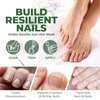 Perfecto Toenail Treatment with Tea Tree Oil - Fingernail and Toe Nail Treatment Extra Strength - Nail Repair Foot Nail Treatment - Renews Foot, Yellow & Cracked Nails