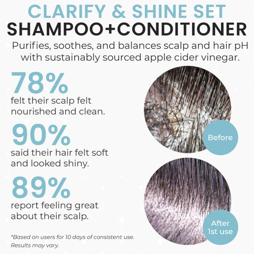 Apple Cider Vinegar Shampoo and Conditioner Set | Deep Cleansing, Frizz Control, Shine Restoration & Scalp Care | Clarifying Shampoo for All Hair Types | 10.14 fl.oz (Pack of 2)