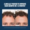 Nutrafol Men's Hair Growth Supplements, Clinically Tested for Visibly Thicker Hair and Scalp Coverage, Dermatologist Recommended - 1 Month Supply