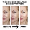 Collagen Face Mask Hydrating Overnight Collagen Face Mask (6 pcs/1 Box) Deep Collagen Anti Wrinkle Lifting Mask - Pure Collagen Films for Improve Elasticity Firming And Moisturizing