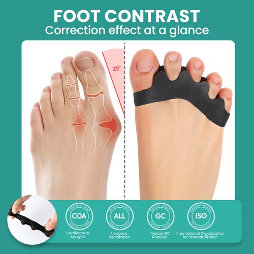 Welnove Toe Separator Bunion Corrector- 8 Pack Toe Straightener for Women Men Overlapping Toes - Toe Spacers for Nighttime, Running & Yoga Practice（Black/Blue*8）