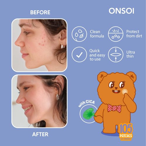 ONSOI 150 Blemish Patch - Hydrocolloid Pimple Patches for Face, Acne Spot Treatment-Cica