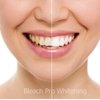 Teeth Whitening Gel 44% Syringes Carbamide Peroxide 20 Tooth Bleaching Gel 3ml Dispensers