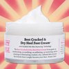 Beauty Of The Nile Best Cracked & Dry Heel Foot Cream™ Remove Dead Callus Moisturize Not Greasy Absorbs Repair Feet Hand Elbow Knee, Urea Mango 5 Oz