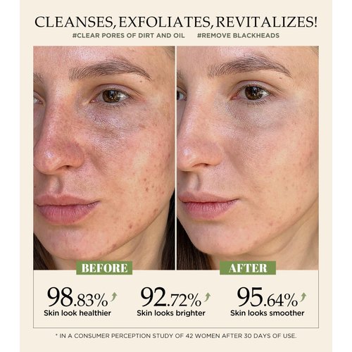 Revitalizing Exfoliation Face Scrub with Vitamin C and Turmeric – Gentle Exfoliating Face Wash for Blackheads, Pore Dirt & Dark Spots – Acne Control Facial Scrub for Oily & Acne-Prone Skin, 4.23 Fl Oz
