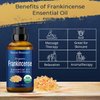 Organic Frankincense Essential Oil 30 ml - Boswellia Serrata - Natural, Pure Frankincense Oil for Diffuser, Aromatherapy - Therapeutic Grade - Skin Use and Hair Care Benefits from Nexon Botanics