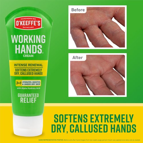 O'Keeffe's Working Hands Intense Renewal Hand Cream, 3oz Tube (Pack of 1) - Softens and Smooths Extremely Dry, Callused Hands