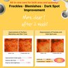 Acropass Spot Care Microcone for Dark Spots - Targeted Post-Blemish Treatment Patch, Dermatologist Approved & Gentle on Skin, Cruelty-Free (6 Patches + 6 Cleansers)