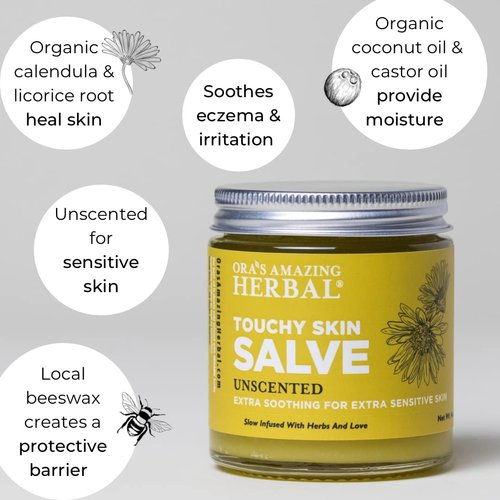 Ora's Amazing Herbal Touchy Skin Salve, Eczema Treatment for Kids and Adults, Eczema Cream, Calendula Cream, Itch Cream, Dermatitis, Dry Hands, Hand Mask Balm, Calendula Ointment with Coconut Oil