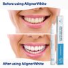 EverSmile AlignerWhite Teeth Whitening Pen | for Clear Aligners and Retainers, Aligner Whitener, Gel Whitening Pen