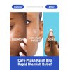 OLIVE YOUNG Care Plus Spot Patch(15 Count * 3 Pack) | Hydrocolloid Acne Spot Patches for Popped or Unpopped Pimples | Waterproof Pore Cleansing Strips for Zits | Strong Adhesion