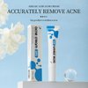 20% Azelaic Acid Cream for Face,Azelaic Acid Moisturize With Hyaluronic Acids for Face Redness, Pimple CreamAnti Acne Breakouts Azelaic Acid Gel Balance Excess Oil & Soothing No Irritation