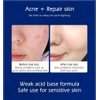 Cystic, Hormonal, Severe Acne Treatment Cream for Teens & Adults with Hyaluronic Acid Aloe Vera Oil Overnight Cystic , Unisex Sensitive Skin Blind Pimple & Blemish Remover (1 PACK)