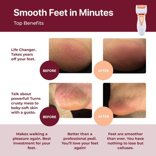 Own Harmony Professional Foot Care for Women: Rechargeable Callus Remover for Feet Electric Foot Sander - Electronic Foot File CR900 with 3 Rollers, Foot Grinder Pedi for Cracked Heels & Hard Skin