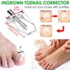Ingrown Toenail Removal Kit, Ingrown Toenail Tool for Ingrown & Thick Nail Treatment Relieves Toenail Pain, with Correction Clippers, Corrector Strips, Corrector Patch, File, Lifter Pedicure (8pcs)