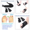 Bunion Corrector and Hallux Valgus Pain Relief Kit | Orthopedic Big Toe Straightener | Adjustable Splint Protective Sleeves | Toe Separator Spacer, Splint Correction Aid for Women,Men - 11 Pack