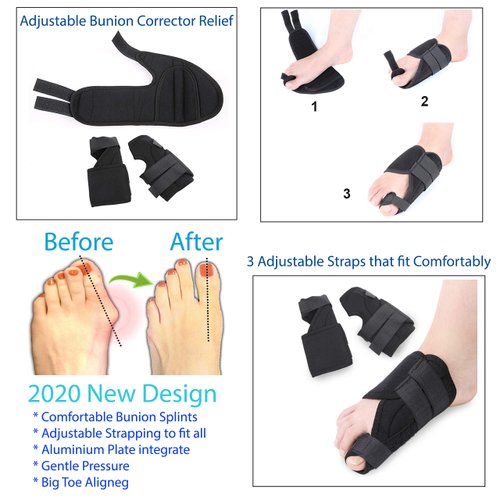 Bunion Corrector and Hallux Valgus Pain Relief Kit | Orthopedic Big Toe Straightener | Adjustable Splint Protective Sleeves | Toe Separator Spacer, Splint Correction Aid for Women,Men - 11 Pack