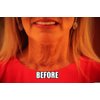 NeckTITE Magic - The Instant Neck Lift