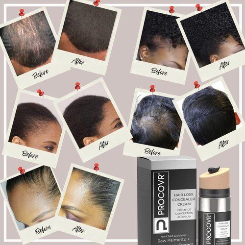 PROCOVR The ORIGINAL Thinning Hair and Hairline Concealer, Natural Hair Mascara for Balding Areas, Root Touch-Up for Thicker Appearance (Natural Brown FBA)