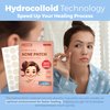 Acne Patches for Face - Hydrocolloid Bandages (360 Count) Pimple Patches for Face in 2 Universal Sizes, Acne Spot Treatment Care for Face & Skin Spot Patch Conceals Zits, Acne and Blackheads