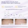 Glytone Face Cleanser Mild Cream, Face Wash for Women, Hydrating Facial Cleanser with Glycolic Acid, Glycerin, Exfoliate & Moisturize Cleanser, 13.5oz