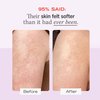 First Aid Beauty - KP Bump Eraser Body Scrub with 10% AHA, Keratosis Pilaris Skin Exfoliater with Glycolic and Lactic acids, Helps Reduce Chicken Skin Bumps, Safe for Sensitive Skin, 8 oz + Bonus, 2ct