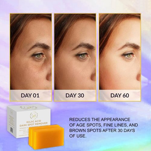 GoldSnailRX KOJIC ACID SOAP Original Dark Spot Remover (PACK OF 2 W/BAG) Authentic Kojic Acid Soap For Body Whitening-Kojic Acid Soap with Vitamin C,Tumeric, infused w/Hyaluronic Acid,Shea Butter
