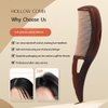 KFASANOMDZ Hair Comb, Dandruff Removal Comb Plastic, All Hair Types, Manual, for People with Dandruff Problems
