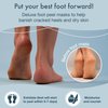 Blue Oasis Foot Peeling Mask - Exfoliating Foot Mask for Dry Cracked Feet, Peach Cracked Heel Treatment, Moisturizing Foot Peel Mask, Luxury Foot Care for Baby Soft Feet, Foot Exfoliator 4-pack