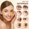 Aivoch 10Pairs 20Pcs 24K Gold Under Eye Patches, Collagen Eye Masks for Dark Circles and Puffiness, Reduce Wrinkles and Puffy Eyes, Refresh Your Skin, Women Skincare Eye Treatment Products